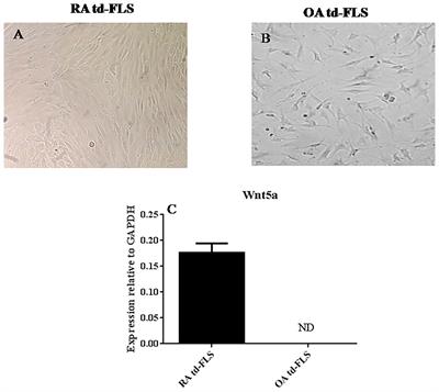 SFRP5 Enhances Wnt5a Induced-Inflammation in Rheumatoid Arthritis Fibroblast-Like Synoviocytes